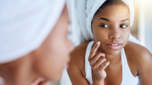 Your Step-by-Step Guide to Tackling Hyperpigmentation Like a Pro